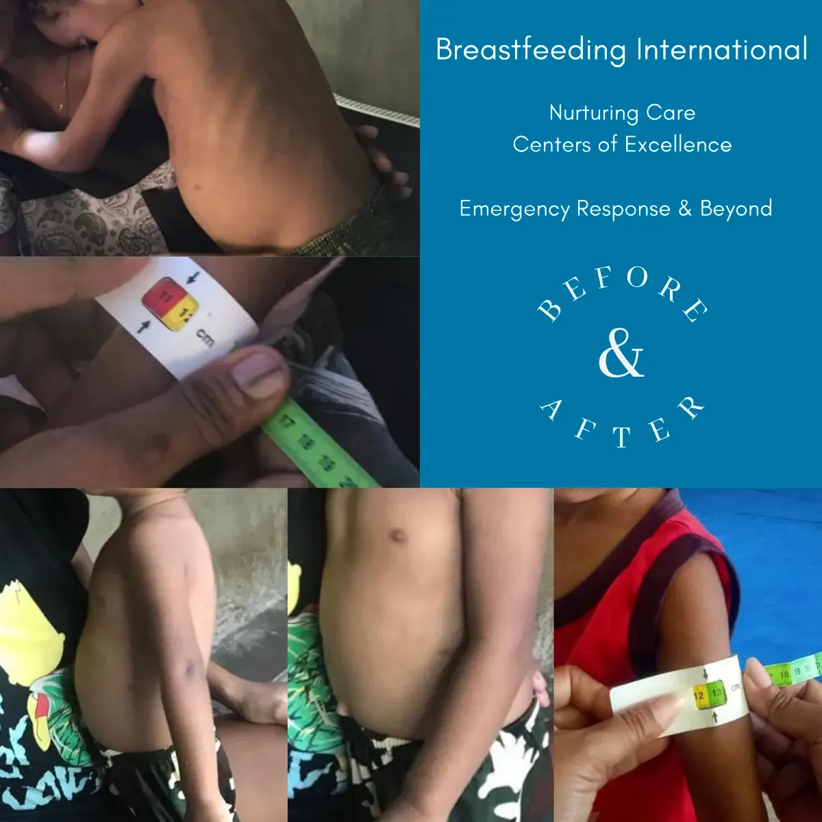 Donation-image Donate to Breastfeeding International